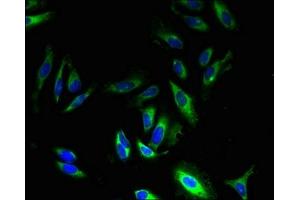 Immunofluorescent analysis of Hela cells using ABIN7164509 at dilution of 1:100 and Alexa Fluor 488-congugated AffiniPure Goat Anti-Rabbit IgG(H+L) (GPR83 antibody  (AA 349-423))