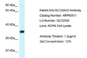 Western Blotting (WB) image for anti-Solute Carrier Family 25, Member 33 (SLC25A33) (Middle Region) antibody (ABIN2788474) (SLC25A33 antibody  (Middle Region))