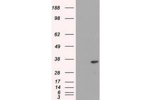 Image no. 3 for anti-DNA Fragmentation Factor, 45kDa, alpha Polypeptide (DFFA) antibody (ABIN1498772) (DFFA antibody)