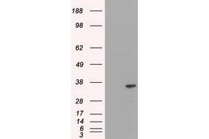 Image no. 3 for anti-DNA Fragmentation Factor, 45kDa, alpha Polypeptide (DFFA) antibody (ABIN1498772)