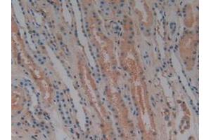 Immunohistochemistry (IHC) image for anti-Complement Factor H (CFH) (AA 860-1231) antibody (ABIN7432274)