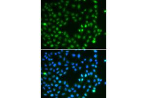 Immunofluorescence analysis of A549 cells using SALL4 antibody (ABIN5974283). (SALL4 antibody)