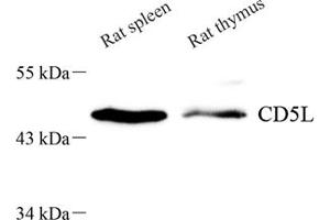Western blot analysis of CD5L (ABIN7073398) at dilution of 1: 700 (CD5L antibody)
