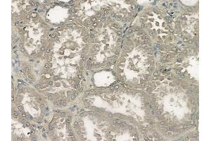 ABIN6264956 and ABIN6272486 at 1/100 staining human normal kidney tissue by IHC-P. (SEC22B antibody  (Internal Region))