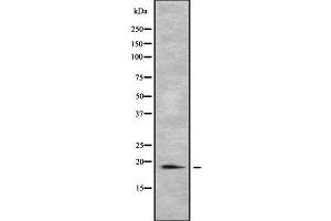 Western blot analysis of PTRH2 using COLO205 whole cell lysates (PTRH2 antibody  (Internal Region))