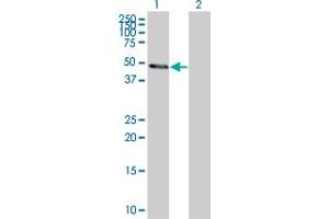 Lane 1: DNAJA3 transfected lysate ( 52. (DNAJA3 293T Cell Transient Overexpression Lysate(Denatured))