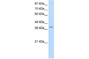 WB Suggested Anti-MYST4 Antibody Titration:  0. (KAT6B antibody  (N-Term))