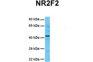 Western Blotting (WB) image for anti-Nuclear Receptor Subfamily 2, Group F, Member 2 (NR2F2) (N-Term) antibody (ABIN2792599)