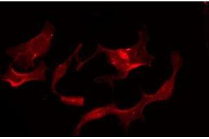 ABIN6275954 staining Hela by IF/ICC. (G Protein-Coupled Receptor 119 antibody  (Internal Region))