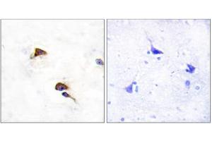 Immunohistochemistry analysis of paraffin-embedded human brain tissue using PPIF antibody. (PPIF antibody  (Internal Region))