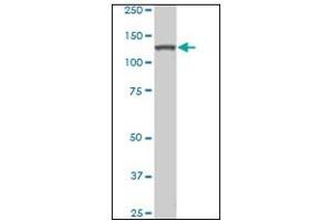 Western Blotting (WB) image for anti-Homeodomain Interacting Protein Kinase 2 (HIPK2) antibody (ABIN781914)
