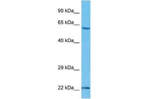 Host:  Rabbit  Target Name:  UBE2E2  Sample Tissue:  Human HepG2 Whole Cell  Antibody Dilution:  1ug/ml (UBE2E2 antibody  (N-Term))