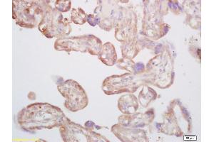 Formalin-fixed and paraffin embedded human placenta labeled with Rabbit Anti CYP5A1/Thromboxane synthase Polyclonal Antibody, Unconjugated (ABIN752623) at 1:200 followed by conjugation to the secondary antibody and DAB staining