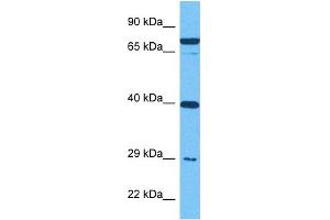 Host:  Rabbit  Target Name:  IGFBP4  Sample Tissue:  Human MDA-MB-435s Whole Cell  Antibody Dilution:  1ug/ml (IGFBP4 antibody  (Middle Region))