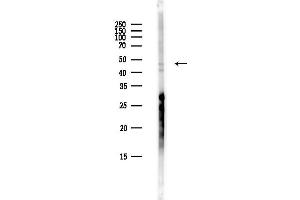Western blot analysis of lysates from Hela cells(heat-shock,45 min treatment), using ADSSL1 Antibody at 1/1000 dilution.