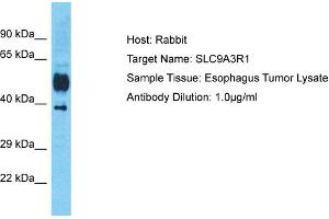 Host: Rabbit Target Name: SLC9A3R1 Sample Tissue: Human Esophagus Tumor Antibody Dilution: 1ug/ml (SLC9A3R1 antibody  (C-Term))