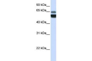 Western Blotting (WB) image for anti-Sphingomyelin phosphodiesterase 1, Acid Lysosomal (SMPD1) antibody (ABIN2458155) (SMPD1 antibody)