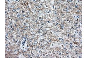 Immunohistochemical staining of paraffin-embedded Human liver tissue using anti-IGF2BP2 mouse monoclonal antibody. (IGF2BP2 antibody)