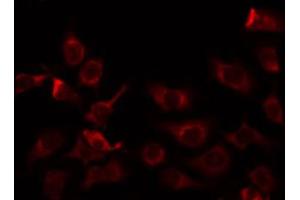 ABIN6274746 staining COLO205 by IF/ICC. (MRPL9 antibody  (C-Term))
