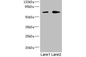 Western blot All lanes: REC8 antibody at 1.