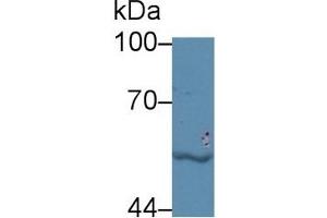Detection of LBP in Human Jurkat cell lysate using Polyclonal Antibody to Lipopolysaccharide Binding Protein (LBP) (LBP antibody  (AA 224-468))