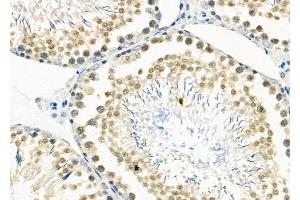 ABIN6265535 and ABIN6266529 at 1/100 staining Rat testis tissue by IHC-P.