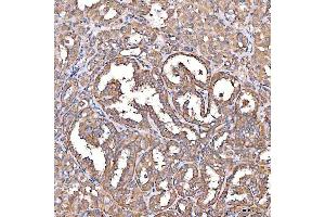 IHC analysis of TTLL2 using anti-TTLL2 antibody (ABIN7600850). (TTLL2 antibody  (AA 24-582))