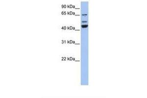 Image no. 1 for anti-Vacuolar Protein Sorting-Associated Protein 4A (VPS4A) (AA 74-123) antibody (ABIN6739022) (VPS4A antibody  (AA 74-123))