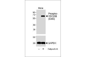 Western blot analysis of lysates from Hela cell line, untreated or treated with 20 % FBS + 100nM Calyculin A, 15 min, using Phospho-CDC25B Antibody (upper) or GDH(lower). (CDC25B antibody  (pSer353))