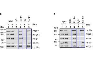 Immunoprecipitation (IP) image for anti-Poly (ADP-Ribose) Polymerase 1 (PARP1) antibody (ABIN2854798)