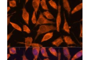 Immunofluorescence analysis of L929 cells using SCRN3 Polyclonal Antibody at dilution of 1:100. (Secernin 3 antibody)