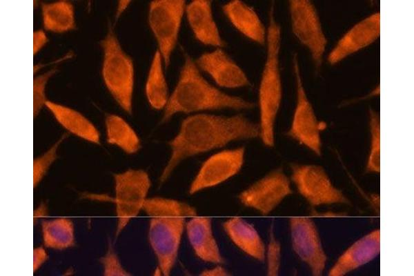 Secernin 3 antibody