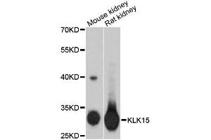 Western blot analysis of extracts of various cell lines, using KLK15 antibody (ABIN1873439) at 1:3000 dilution. (Kallikrein 15 antibody)