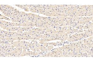 Immunohistochemistry (IHC) image for anti-Lactate Dehydrogenase B (LDHB) (AA 1-334) antibody (ABIN7433966)