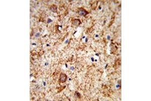 Formalin-fixed and paraffin-embedded human brain tissue reacted with Nociceptin  Antibody , which was peroxidase-conjugated to the secondary antibody, followed by DAB staining. (Nociceptin antibody  (Middle Region))