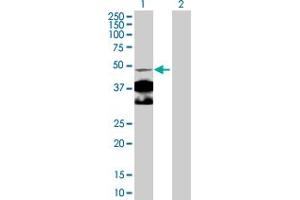 Western Blot analysis of NR4A1 expression in transfected 293T cell line by NR4A1 MaxPab polyclonal antibody. (NR4A1 antibody  (AA 1-598))