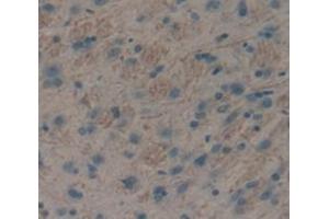 IHC-P analysis of Rat Tissue, with DAB staining. (Insulin Receptor antibody  (AA 1114-1382))
