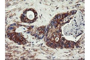 Image no. 1 for anti-Ubiquitin-Conjugating Enzyme E2, J1, U (UBE2J1) antibody (ABIN1501637) (UBE2J1 antibody)