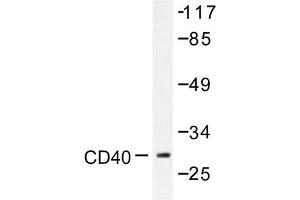 Image no. 1 for anti-CD40 (CD40) antibody (ABIN271944) (CD40 antibody)