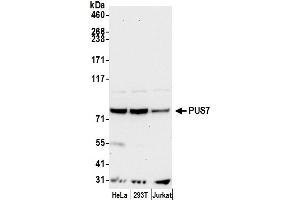 anti-Pseudouridylate Synthase 7 Homolog (PUS7) (AA 100-150) antibody