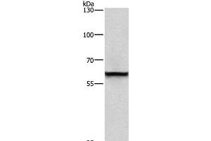 Western Blot analysis of A431 cell using TRIP4 Polyclonal Antibody at dilution of 1:400 (TRIP4 antibody)