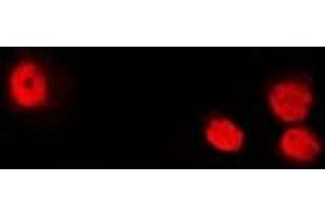 Immunofluorescent analysis of ATIC staining in U2OS cells. (ATIC antibody)