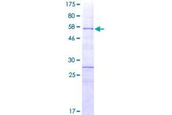 HOXA9 Protein (AA 1-272) (GST tag)
