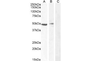 ABIN190840 (0. (Carabin antibody  (Internal Region))