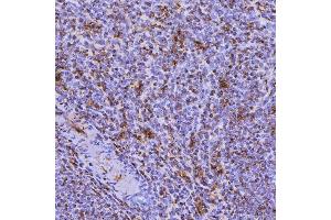 IHC analysis of SEPT6/SEPTIN6 using anti-SEPT6/SEPTIN6 antibody (ABIN7599390). (Septin 6 antibody  (AA 1-434))