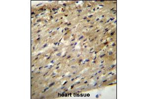 ABCD2 Antibody (C-term) (ABIN656554 and ABIN2845816) immunohistochemistry analysis in formalin fixed and paraffin embedded human heart tissue followed by peroxidase conjugation of the secondary antibody and DAB staining. (CCL17 antibody  (C-Term))