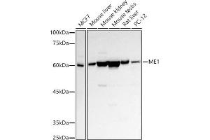 Western blot analysis of extracts of various cell lines, using ME1 antibody (ABIN1680809, ABIN3018339, ABIN3018340 and ABIN6220439) at 1:500 dilution. (ME1 antibody  (AA 1-300))