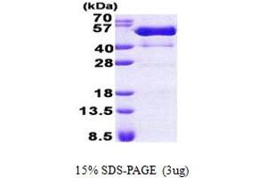 Proline-serine-threonine Phosphatase Interacting Protein 1 (PSTPIP1) (AA 1-416) protein (His tag)