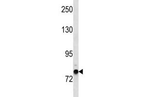 Western Blotting (WB) image for anti-Zinc Finger Protein 12 (ZNF12) antibody (ABIN3004528) (ZNF12 antibody)