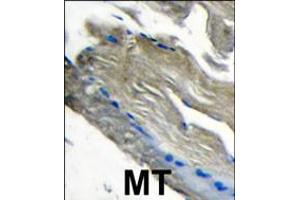 Formalin-fixed and paraffin-embedded human muscle tissue tissue reacted with PI3CKG antibody , which was peroxidase-conjugated to the secondary antibody, followed by DAB staining. (PIK3 gamma antibody  (C-Term))